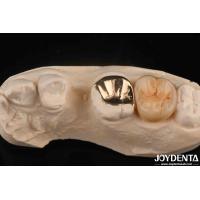 Buy cheap Custom Oral Clinical Wear Resistant Gold Dental Crown With 60K Metallic product