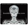 Buy cheap Medical X Ray Thermal Printer Film KND-F25*30cm from wholesalers