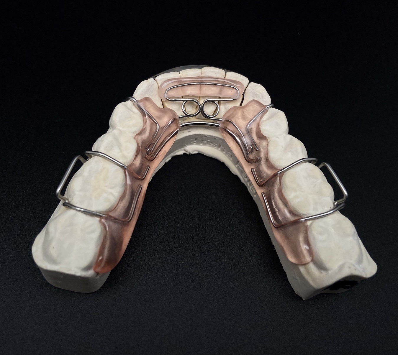 Comfortable Stainless Steel Acrylic Hawley Retainer Effective Orthodontic Solution