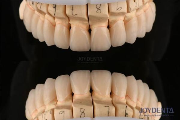 Buy cheap Polished Layered Dental Zirconia 0.3-0.5mm Thickness With CAD CAM Technology from wholesalers
