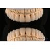 Buy cheap Polished Layered Dental Zirconia 0.3-0.5mm Thickness With CAD CAM Technology from wholesalers