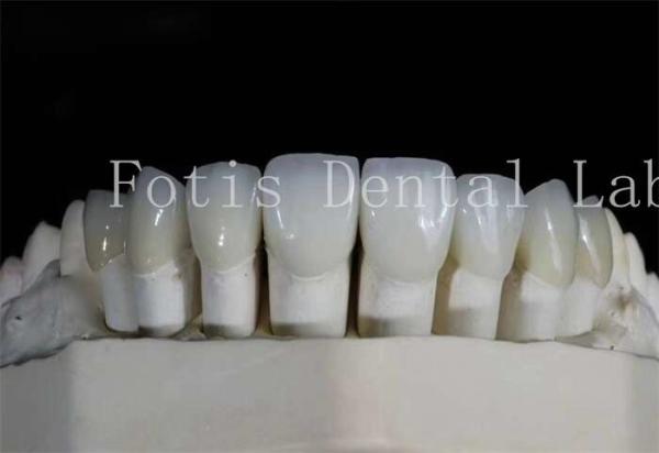 Buy cheap Polished Dental Laminate Veneers High Translucency For Natural Looking Smiles from wholesalers
