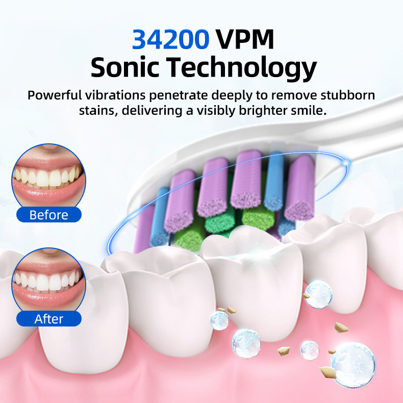 Sonic Soft Bristle Cepillos De Dientes Electronic Brosse a Dents Electric Toothbrush