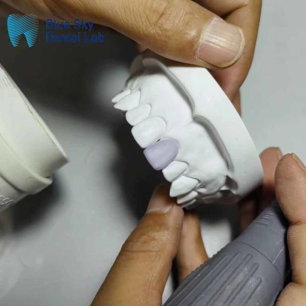 Buy cheap 0.3mm Thin Glass Ceramic Veneer Implants Lightweight Veneer Cases from wholesalers