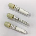 Sodium Flouride Glucose Blood Tube 1-8ml Draw Volume Accurate Ratio