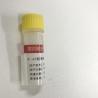 Buy cheap KISSH Primary Antibody Products Ki-67 Immunoassay Antibody Test IHC 1.5mL 3.0mL from wholesalers