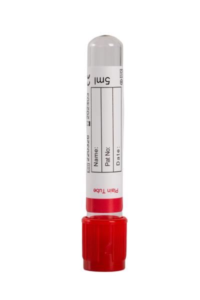 Supported Mixed Batch Orders Vacuum Blood Test Tube with PP 10X45 Packaging