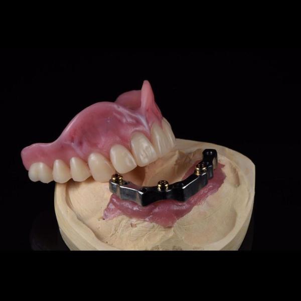 Buy cheap CAM Milled Titanium Bar Dental Implant Hybrid Prosthesis Dentures from wholesalers
