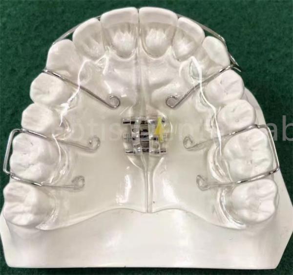 Buy cheap State-Of-The-Art Orthodontics Appliance Expanding Retainer Customizable from wholesalers