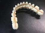 Denture Repair Dental Acrylic Resin Teeth Kit Artificial Synthetic Resin