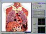 Quantum Resonance 3d Nls Health Analyzer For Full Body Diagnostic