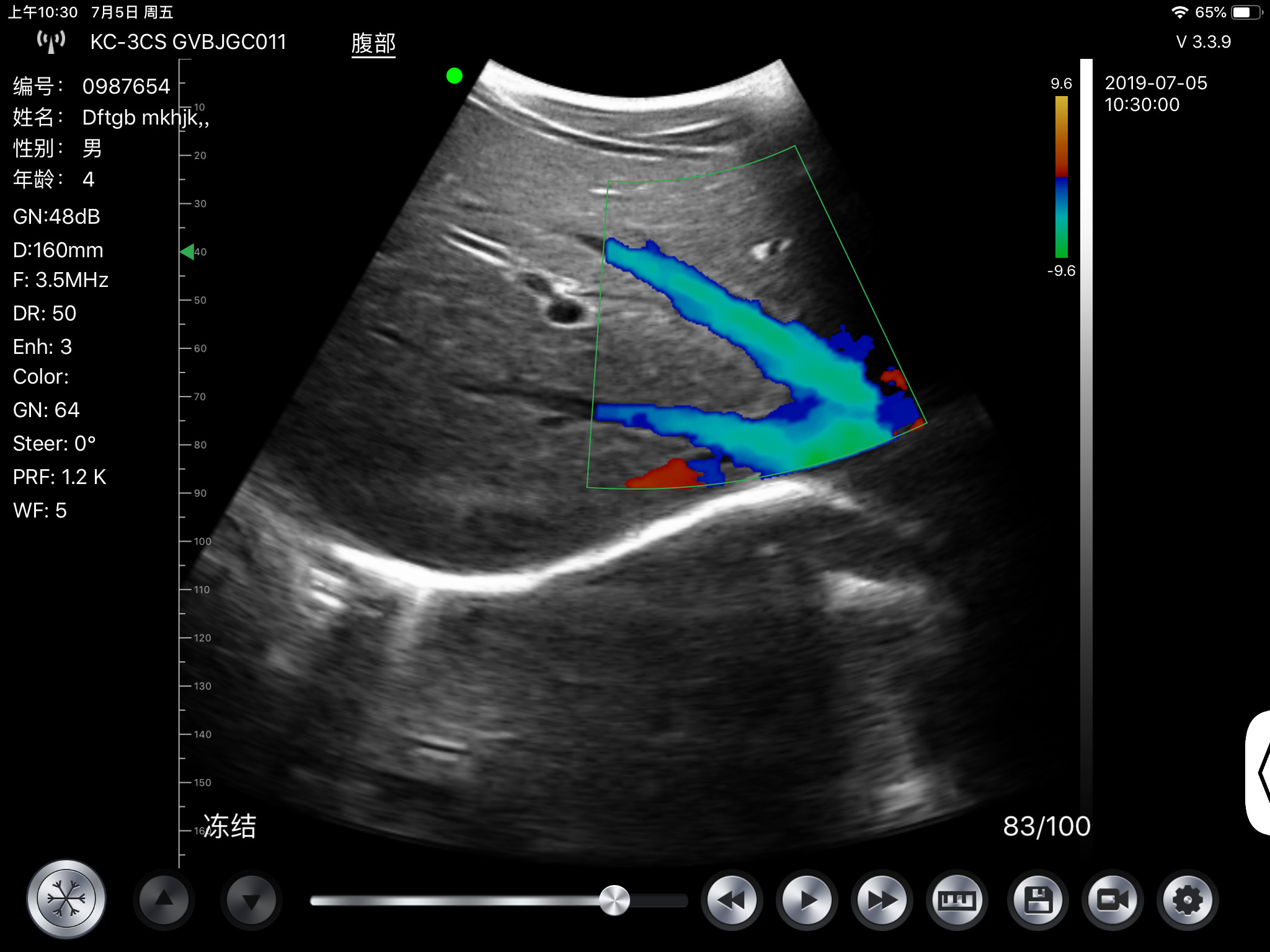 G10cx G10ct Portable Ultrasound Scan Machine Transducer Wireless Doppler Ultrasound Probe