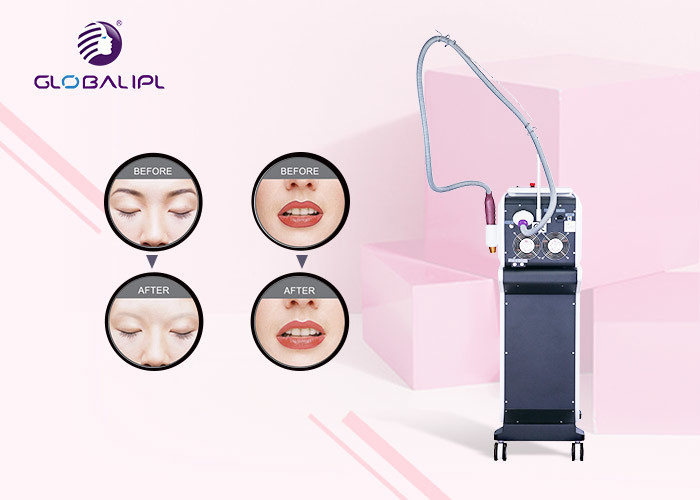 All Color Tattoo Removal ND YAG Laser Machine Pico Laser Beauty Machine