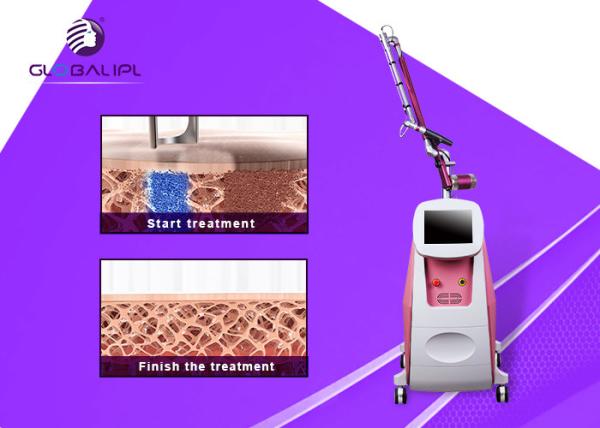 Buy cheap Painless ND YAG Laser Tattoo Removal Machine 1064nm / 532nm Wavelength from wholesalers
