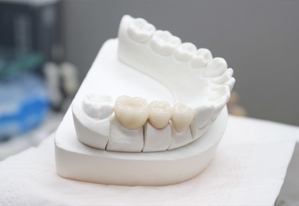 Sliver Dental Base Metal Alloys Removable Prosthesis For CAD CAM Open System