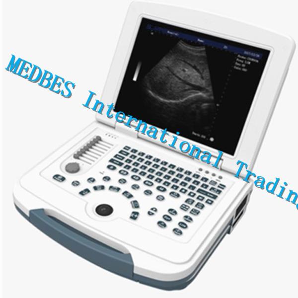 Buy cheap Hospital 15 TFT Color Medical Portable Ultrasound Machine from wholesalers