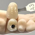 Porcelain Zirconia Cement Retained Screw Implant Hexagonal Head Shape for Custom