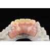 Buy cheap Elaborate Technology Framework Set Up Teeth Finish For Stable Oral Structure In Dental Technology Apply To Dental from wholesalers