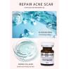 Buy cheap Luxury Youth Serum Injection Mesotherapy Red Spots Skin Acne Injection Treatment from wholesalers