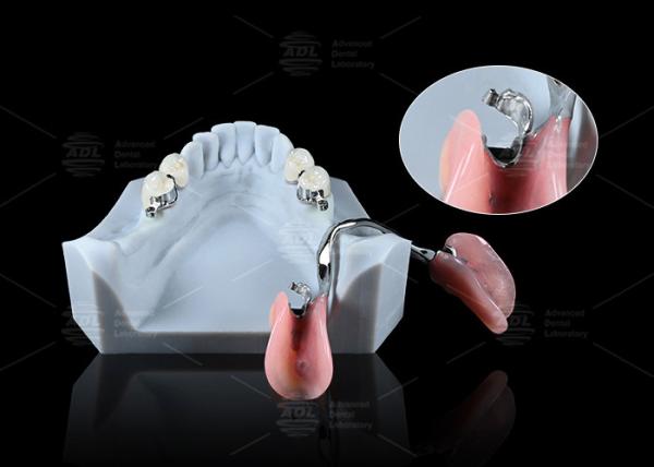 Buy cheap Sleek Precision ERA Dental Attachments For Universal Secure Dental Prosthetics from wholesalers