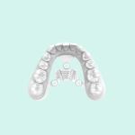 Orthodontic Model Fast Curing Resin White Dental 3d Printer Resin