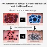 Beauty Salon Use Picosecond Tattoo Removal Machine For Freckle Removal