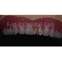 Buy cheap OEM Natural Full Acrylic Denture Ivoclar Teeth Stain Resistance product