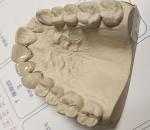 Buy cheap Metal Ceramic Good Fitness PFM Dental Crown from wholesalers