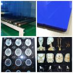 ISO 9001 24 Inch X 30m Medical X Ray Film Blue Laser Transparency Film For