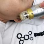 Skin Tightening AC110V 180W Microneedling Fractional RF