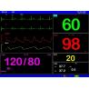 Buy cheap Rechargeable Battery Portable Patient Monitor Compact and Lightweight from wholesalers