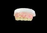 Wieland Zenostar Ceramic Crown Bridge High Precision for Durable and Natural
