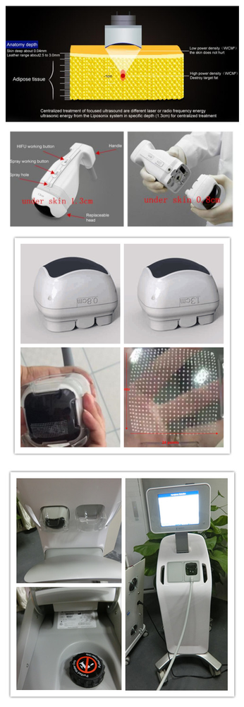 New design lipo laser for lifting machine with great price