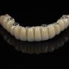Buy cheap Cad Cam Implant PFM Crown Bridge Dental Medical Grade Adhesive from wholesalers