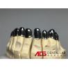 Buy cheap China Dental Lab Dental Implant Attachments Adjustable Telescopic from wholesalers