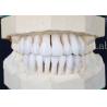 Buy cheap Adhesive Bonding Cement and High Strength Synthetic Laminate Veneers The Perfect Pair from wholesalers