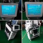 Q-Switched Nd Yag Laser Tattoo Removal skin rejuvenation high energy high