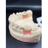 Buy cheap Customization Titanium/Ziconia/PFM Dental Lab Crowns Comfortable from wholesalers