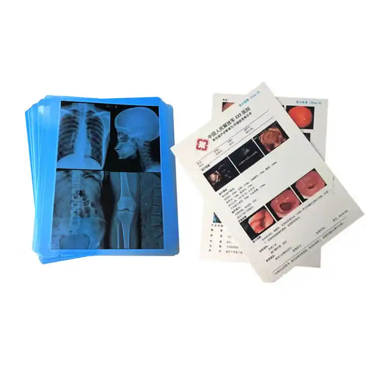 High Resolution Medical Film Inkjet for Clear and Detailed Diagnostic Images