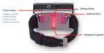 Low Level Laser Therapy Watch for High Blood Sugar Viscosity Cholesterol