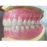 Buy cheap OEM Full Upper And Lower Acrylic Denture Stain Resistance Natural Color from wholesalers