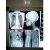 Buy cheap Low Fog 13x17 Inch Medical Dry Film Digital X Ray Film 330mmx432mm from wholesalers