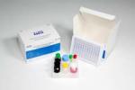 Buy cheap Human Igm Elisa Test EDTA Plasma Antibody Elisa Kit ISO13485 from wholesalers