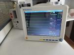 PM-9000GTA Patient Monitor For Emergency Clinics 6 Parameters With Optional