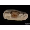 Buy cheap Custom Natural Looking Emax Dental Inlays And Onlays For Tooth Restoration from wholesalers