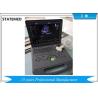 Buy cheap Laptop Ultrasound Color Doppler Ultrasound Scanner With 15 Inch Led Screen from wholesalers