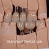 Buy cheap Natural Looking Esthetic Screw Retained Zirconia Implant Crown from wholesalers
