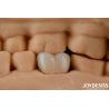 Buy cheap High Strength Zirconia Dental Inlays And Onlays For Tooth Restoration from wholesalers