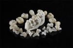 Natural Looking Aesthetic Ceramic Emax Veneer Dental Material Customized