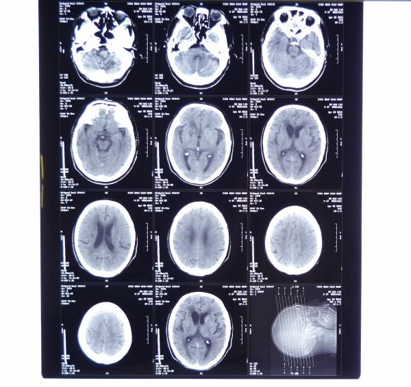 Buy cheap High Sharpness X-ray Dry Dental medical Film, Dry imaging film. x ray laser film from wholesalers